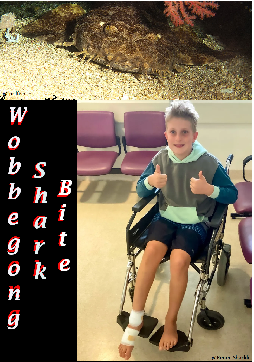 Wobbegong shark bite Austrailia